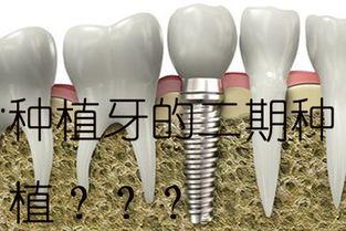 种植牙的过程视频,从术前评估到术后护理